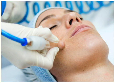 Gabriela Rinaldi - Vacuoterapia